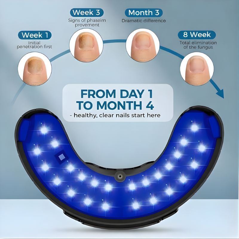 FUNGALOX OmniBeam Therapy Pro